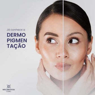 Case Kivra Company — campanha estética